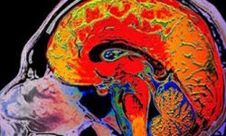 Curso Extensivo de Neuromodulação Clínica